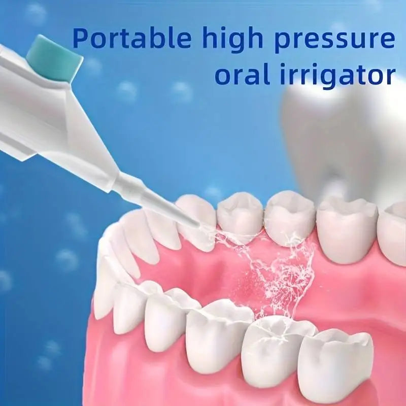 Manual High-Pressure Oral Irrigator – Portable Dental Flosser